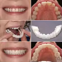 Snap-In Teeth – Instant Perfect Smile Without Dentist