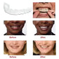 Snap-In Teeth – Instant Perfect Smile Without Dentist