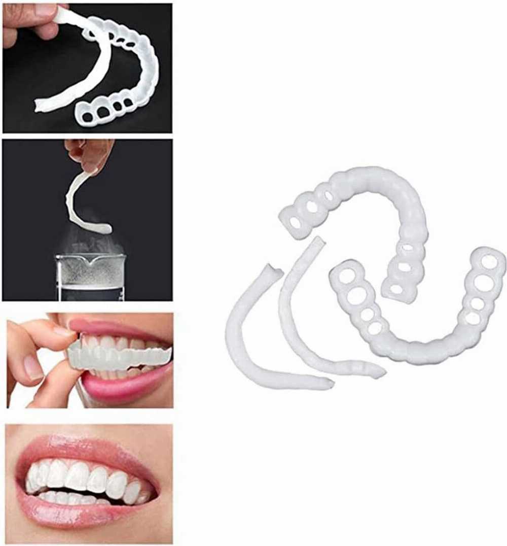 Snap-In Teeth – Instant Perfect Smile Without Dentist