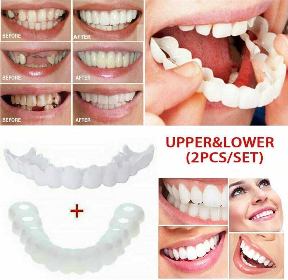 Snap-In Teeth – Instant Perfect Smile Without Dentist